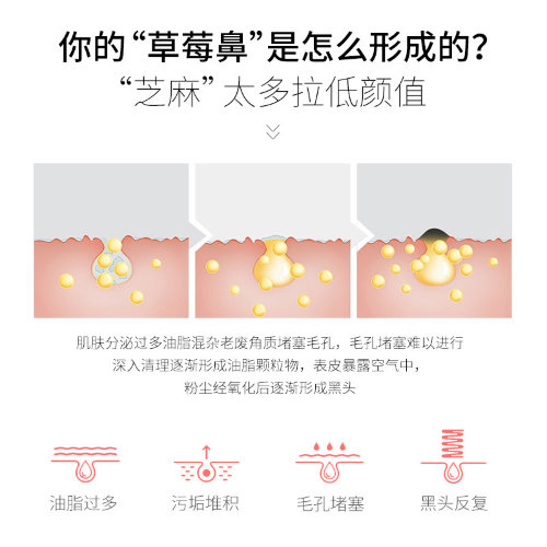 Cindynal Очищающие полоски для носа от черных точек 3в1, 21г