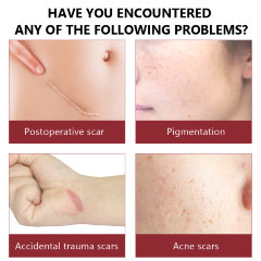 Vibrant Glamour Сыворотка отбеливающая для удаления рубцов от акне, 30мл