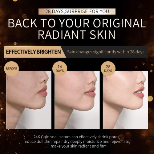 Laikou 24-каратное золото Антивозрастная сыворотка с секретом улитки 24K Gold Snаil Septum Anti-aging, 17мл