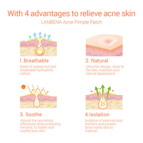 Lanbena Патч-пластырь против акне Acne Pimple Patch, 25шт
