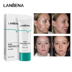 Lanbena Крем для лица против акне Acne Solution Gel, 20г